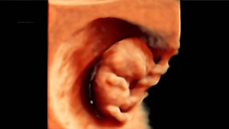 Ecografía de implantación embrionaria: Una herramienta optimizada para el éxito en la reproducción asistida