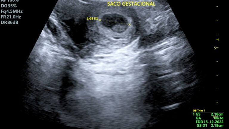 La posibilidad de revitalizar el latido del corazón de un embrión